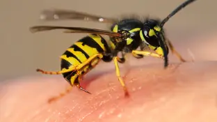 Picadura avispa Picadura avispa