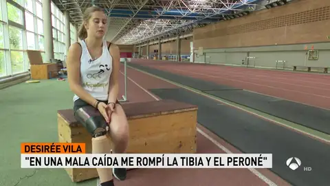 desirre_pierna desirre_pierna