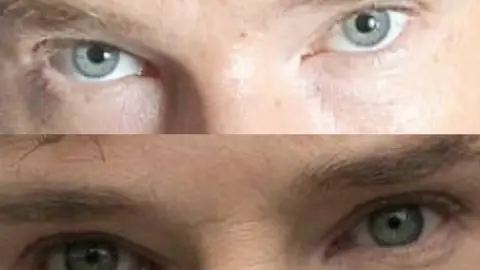 Benedict Cumberbatch Benedict Cumberbatch, heterocromía