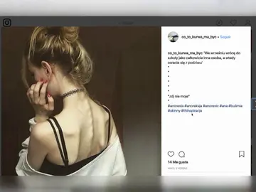 Las redes sociales hacen que aumente el número de casos de anorexia Las redes sociales hacen que aumente el número de casos de anorexia