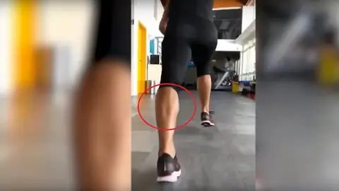 Así se rompe el tendón de Aquiles Así se rompe el tendón de Aquiles