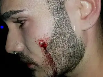 Agredido en la discoteca de Alcorcón Agredido en la discoteca de Alcorcón