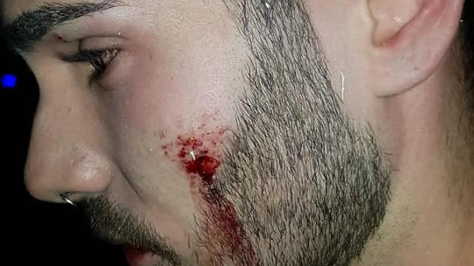 Agredido en la discoteca de Alcorcón Agredido en la discoteca de Alcorcón