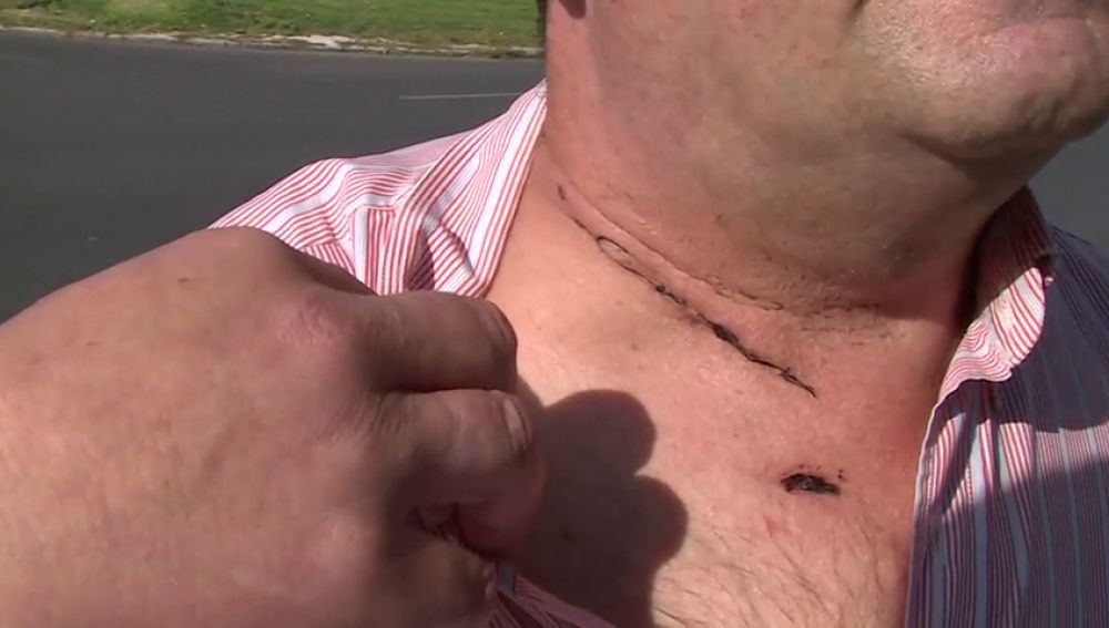 Un taxista sobrevive tras un atraco en el que le cortaron el cuello
