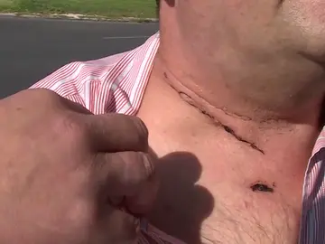 Un taxista sobrevive tras un atraco en el que le cortaron el cuello Un taxista sobrevive tras un atraco en el que le cortaron el cuello