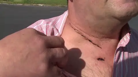 Un taxista sobrevive tras un atraco en el que le cortaron el cuello Un taxista sobrevive tras un atraco en el que le cortaron el cuello