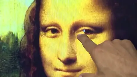 La Gioconda podría padecer problemas de salud, según un doctor de Harvard La Gioconda podría padecer problemas de salud, según un doctor de Harvard