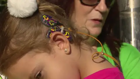 Familias de niños con sordera piden en el Congreso ayudas para implantes cocleares Familias de niños con sordera piden en el Congreso ayudas para implantes cocleares