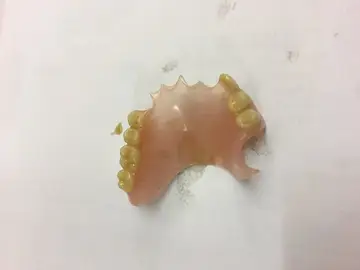 Dentadura postiza Dentadura postiza