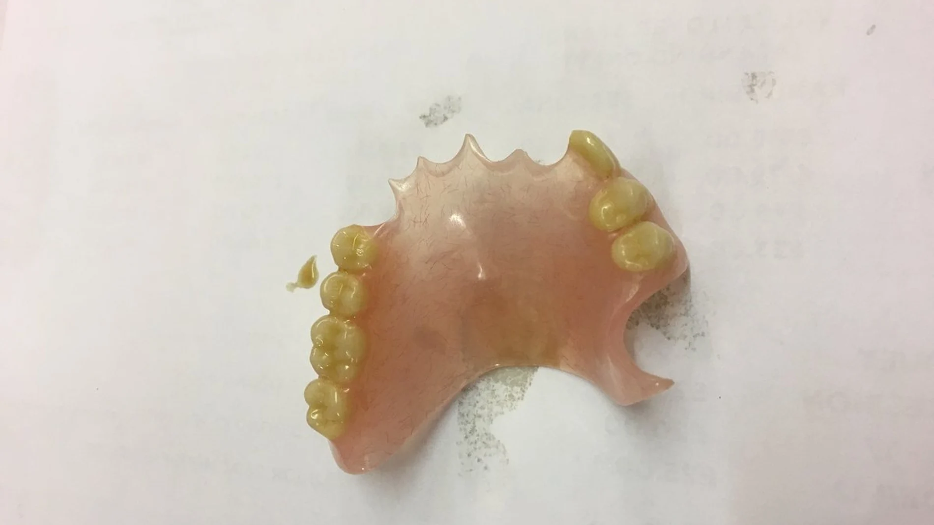 Dentadura postiza Dentadura postiza