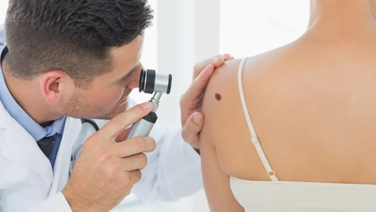Prevención de melanoma Nova Life
