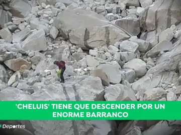 Unas heridas en las manos, las únicas secuelas de 'Cheluis': "Está superemocionado" Unas heridas en las manos, las únicas secuelas de 'Cheluis': "Está superemocionado"