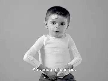 Trece actores españoles se solidarizan con los enfermos de piel de mariposa Trece actores españoles se solidarizan con los enfermos de piel de mariposa