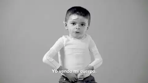 Trece actores españoles se solidarizan con los enfermos de piel de mariposa Trece actores españoles se solidarizan con los enfermos de piel de mariposa