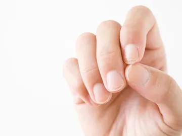 Uñas quebradizas Uñas quebradizas