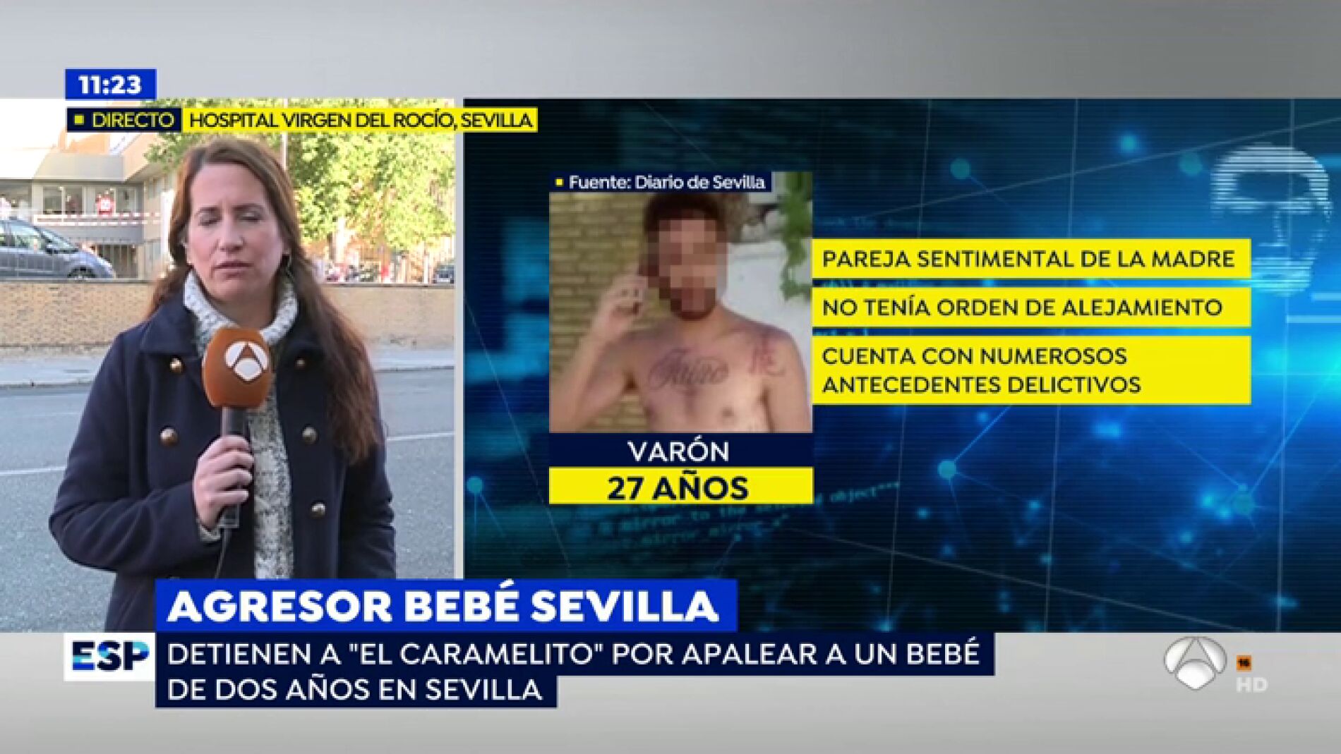 El ni&ntilde;o que recibi&oacute; una brutal paliza de la pareja sentimental de su madre sobrevivir&aacute; tras el contundente golpe en la cabeza