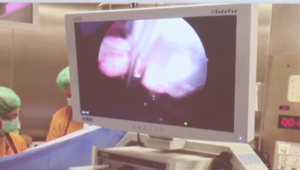Vall d'Hebrón usa imanes para reducir las incisiones en cirugía pediátrica