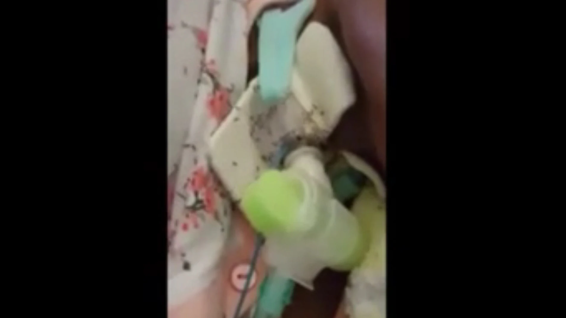 Mujer cubierta por hormigas en un hospital de Italia Mujer cubierta por hormigas en un hospital de Italia