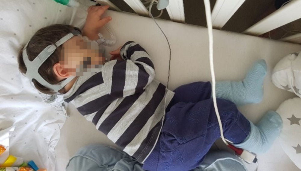 El pequeño Charlie durmiendo con la máscara de respiración puesta