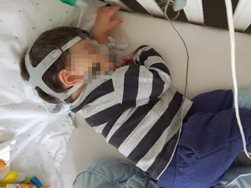 El pequeño Charlie durmiendo con la máscara de respiración puesta El pequeño Charlie durmiendo con la máscara de respiración puesta