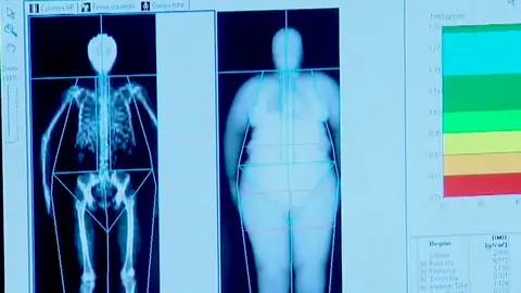 La Conselleria de Sanidad prohibirá la incineración de personas con obesidad mórbida La Conselleria de Sanidad prohibirá la incineración de personas con obesidad mórbida