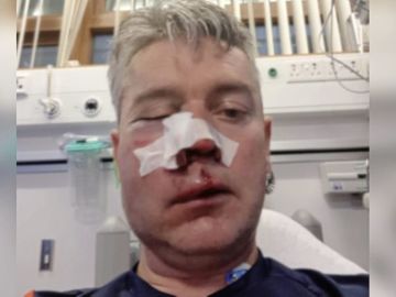 Daniel Sweeney, en el hospital tras la agresión