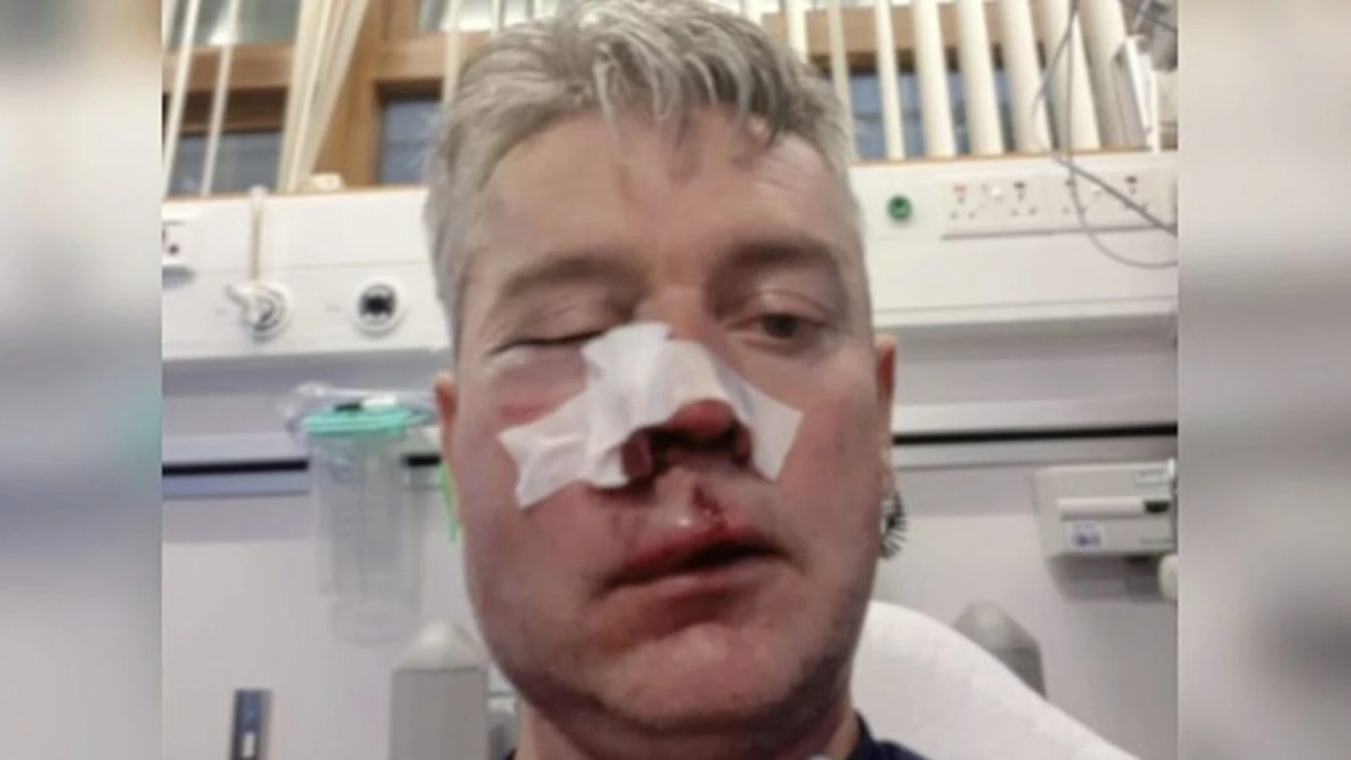 Daniel Sweeney, en el hospital tras la agresión Daniel Sweeney, en el hospital tras la agresión