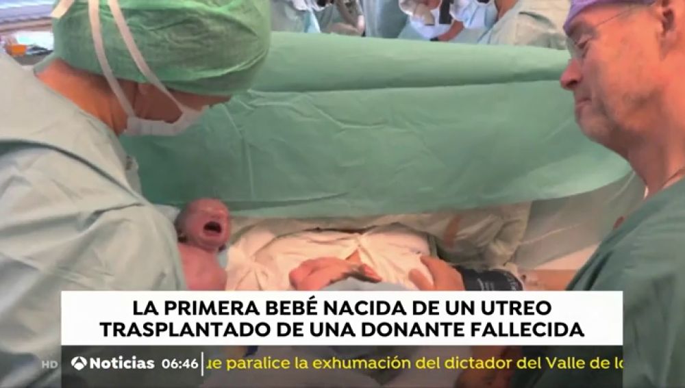 Nace en Brasil la primera bebé del mundo a través de un trasplante de útero de una donante muerta