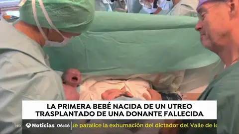 Nace en Brasil la primera bebé del mundo a través de un trasplante de útero de una donante muerta Nace en Brasil la primera bebé del mundo a través de un trasplante de útero de una donante muerta
