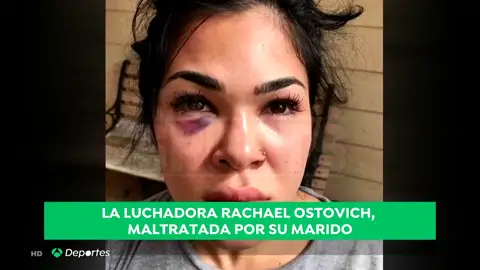 AgresionA3D AgresionA3D