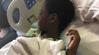 Un niño de seis años, grave por la bacteria 'comecarne' porque tardaron tres días en llevarlo al médico
