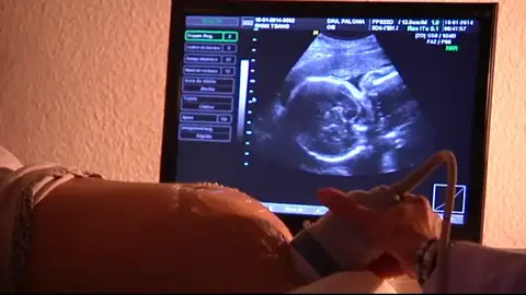 Muere un bebé en Vigo en un parto en casa sin asistencia médica Muere un bebé en Vigo en un parto en casa sin asistencia médica