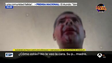 Las impactantes imágenes de Frank Cuesta a punto de morir tras ser disparado por traficantes de animales