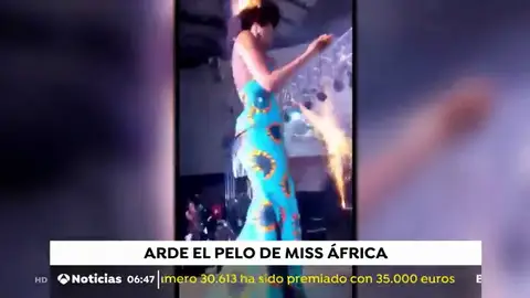 Incendio en el pelo de Miss África Incendio en el pelo de Miss África