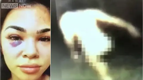 Así fue la huida de Rachael Ostovich Así fue la huida de Rachael Ostovich