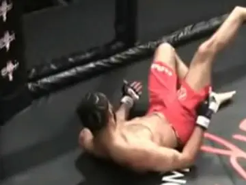 Terrible lesión en el MMA Terrible lesión en el MMA