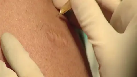 Prueban una vacuna que reduce el virus latente del VIH Prueban una vacuna que reduce el virus latente del VIH