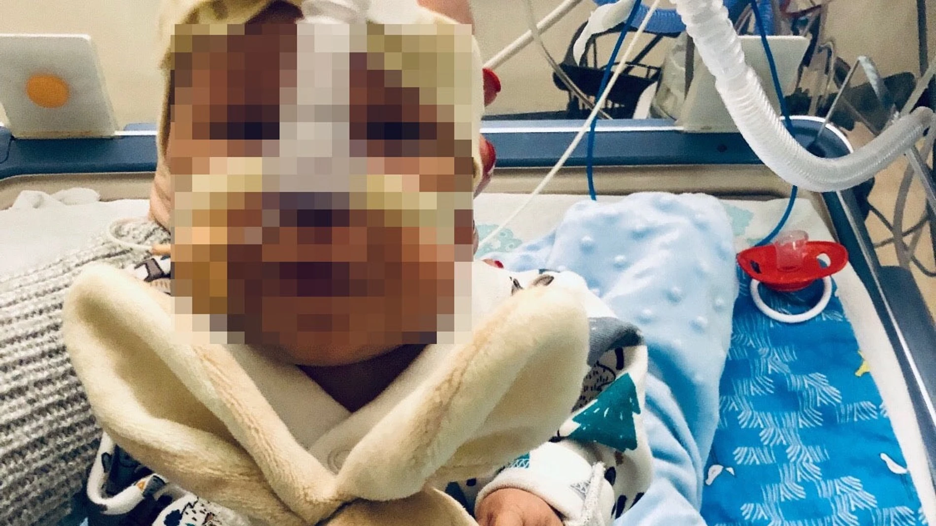 Un bebé sobrevive ante todos los pronósticos médicos Un bebé sobrevive ante todos los pronósticos médicos