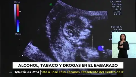Una de cada tres embarazadas consume sustancias tóxicas bebes