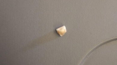 Un pasajero encuentra un diente humano en el plato de comida que le sirvieron en el avión