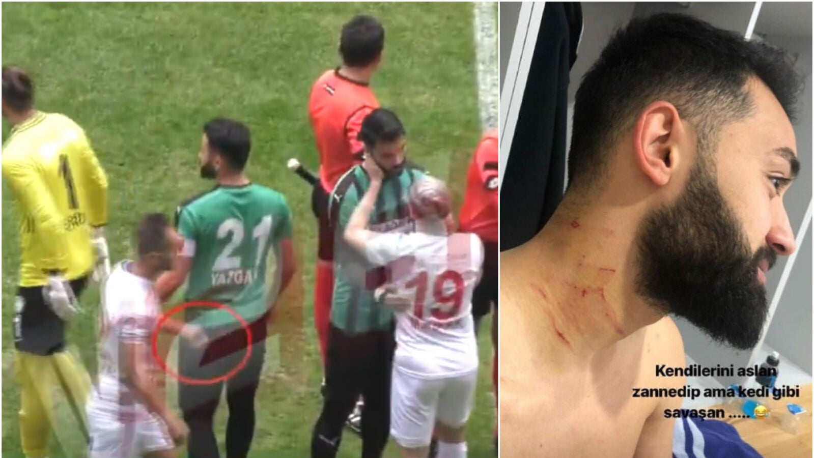 Un futbolista salta al campo con una cuchilla y raja a varios rivales en pleno partido
