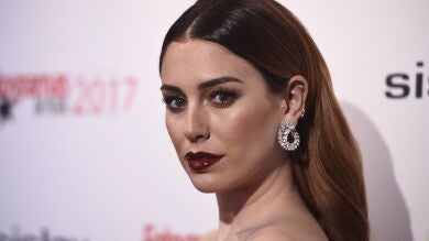 El lado menos bueno de Blanca Suárez