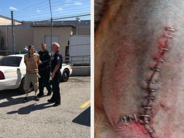 Imagen del detenido y de la lesión del perro