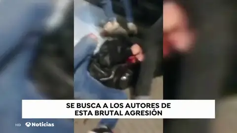 La policía investiga una brutal paliza a un joven en León La policía investiga una brutal paliza a un joven en León