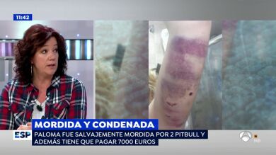 El drama de Paloma tras intentar salvar a una anciana del ataque de un perro: 