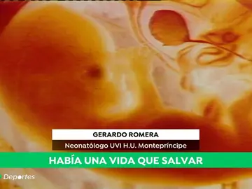 Cerebral_A3D Cerebral_A3D