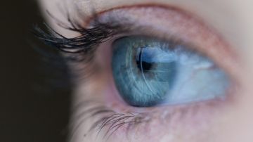 Diagnostican a una niña de cinco años varios tumores oculares en un ojo