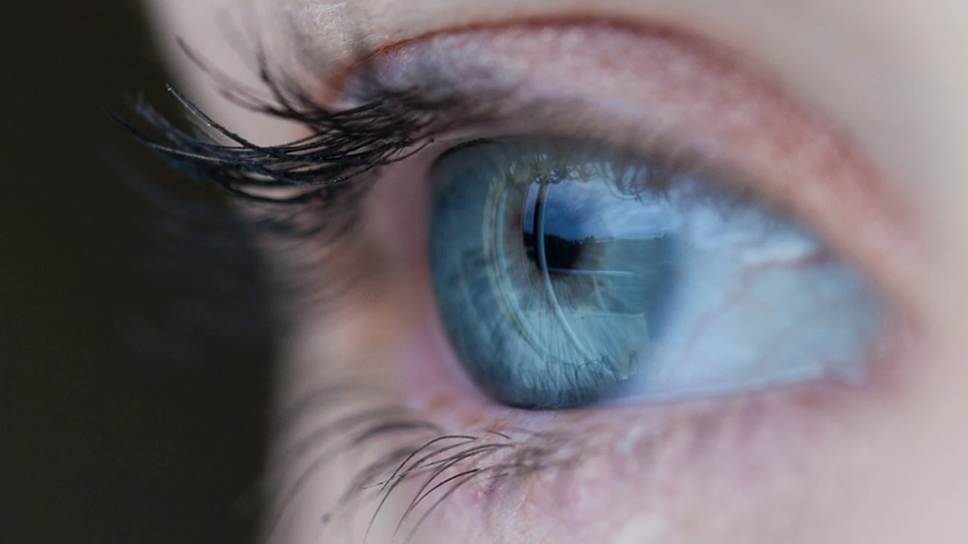 Diagnostican a una niña de cinco años varios tumores oculares en un ojo Diagnostican a una niña de cinco años varios tumores oculares en un ojo
