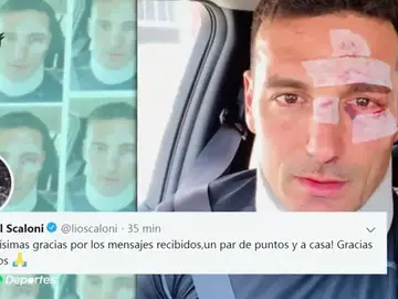 Atropellan al seleccionador argentino Lionel Scaloni cuando iba en bicicleta por Mallorca Atropellan al seleccionador argentino Lionel Scaloni cuando iba en bicicleta por Mallorca