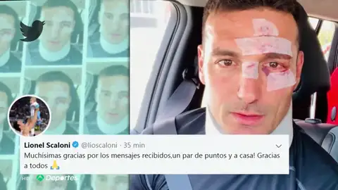 Atropellan al seleccionador argentino Lionel Scaloni cuando iba en bicicleta por Mallorca Atropellan al seleccionador argentino Lionel Scaloni cuando iba en bicicleta por Mallorca